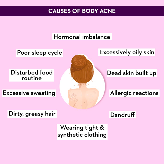 How to Get Rid of Hormonal Body Acne on the Back, Chest