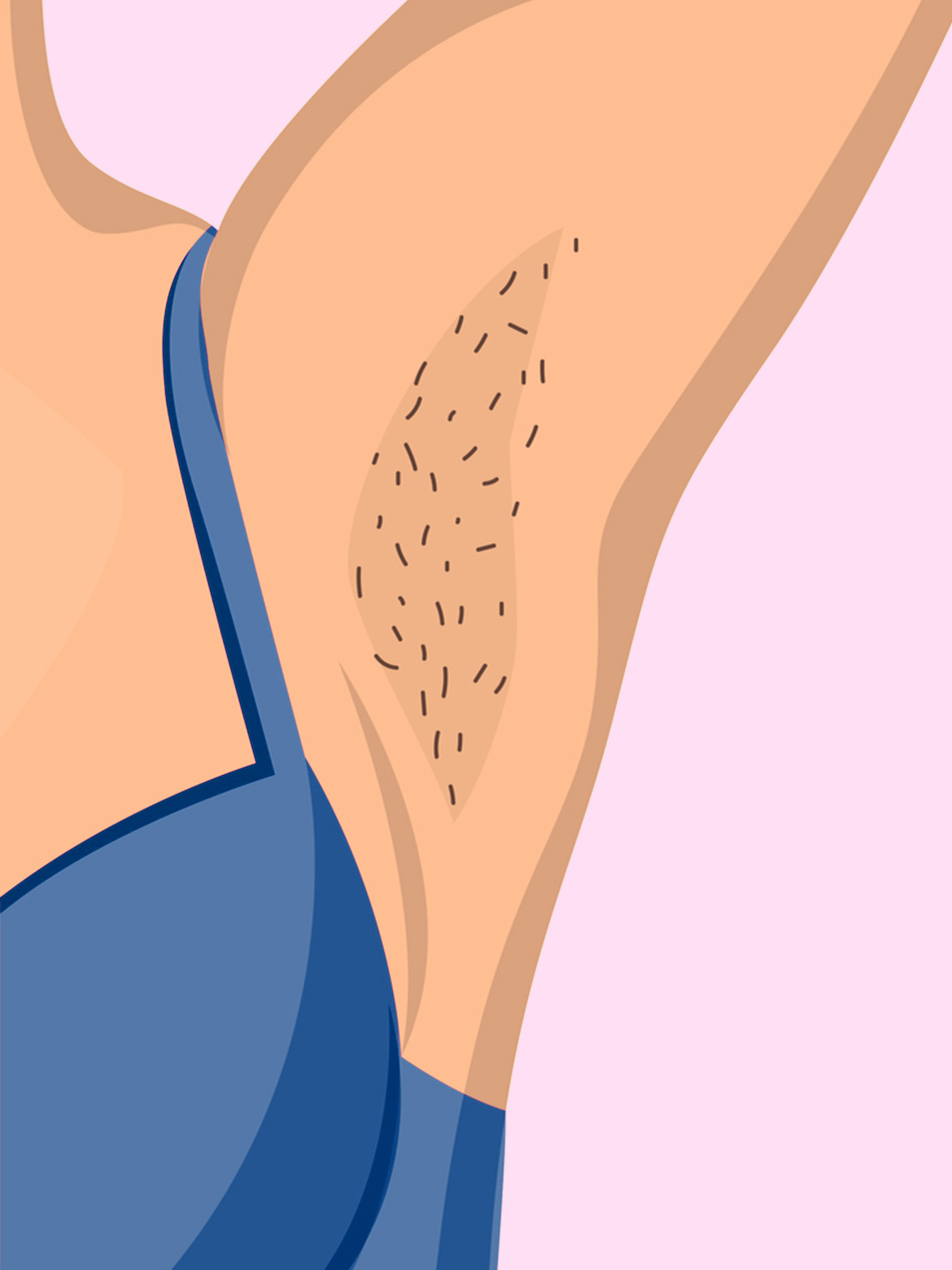 14 Home Remedies to Get Rid of Dark Underarms and Inner Thighs