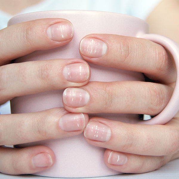 Here's what white marks on nails really signify | Here's what white marks  on nails really signify